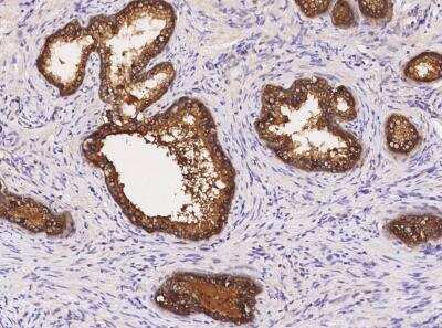Immunohistochemistry-Paraffin: SIAE Antibody (03) [NBP3-06150]