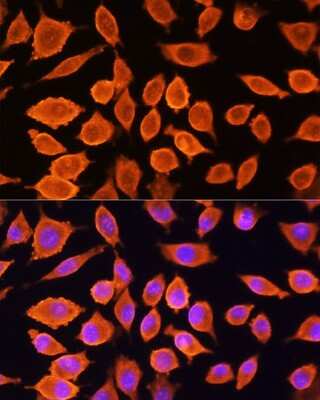 Immunocytochemistry/ Immunofluorescence: SIAH1 Antibody - Azide and BSA Free [NBP2-93864]