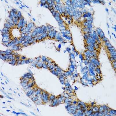 Immunohistochemistry-Paraffin: SIAH1 Antibody - Azide and BSA Free [NBP2-93864]