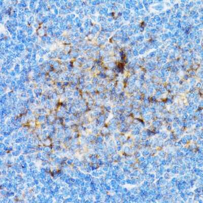 Immunohistochemistry-Paraffin: SIAH1 Antibody - Azide and BSA Free [NBP2-93864]