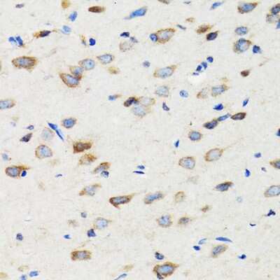 Immunohistochemistry-Paraffin: SIAH1 Antibody - Azide and BSA Free [NBP2-93864]