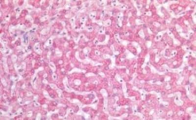 Immunohistochemistry-Paraffin: SIAH2 Antibody [NBP3-14470]