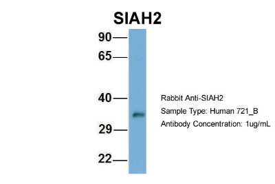 Western Blot: SIAH2 Antibody [NBP2-85729]