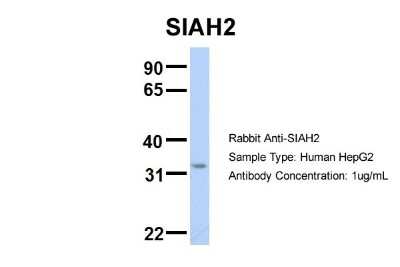 Western Blot: SIAH2 Antibody [NBP2-85730]