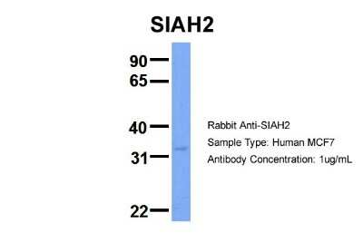 Western Blot: SIAH2 Antibody [NBP2-85730]