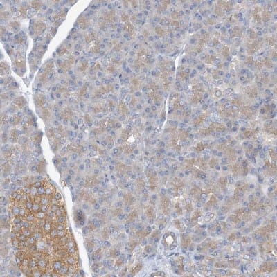 Immunohistochemistry-Paraffin: SIDT1 Antibody [NBP1-82200]