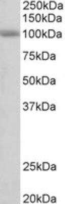 Western Blot: SIDT1 Antibody [NBP2-27547]