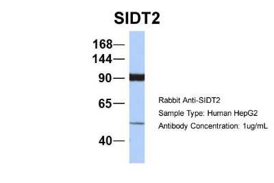 Western Blot: SIDT2 Antibody [NBP1-91551]