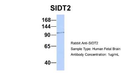 Western Blot: SIDT2 Antibody [NBP1-91551]