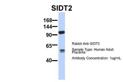Western Blot: SIDT2 Antibody [NBP1-91551]
