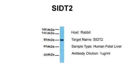 Western Blot: SIDT2 Antibody [NBP1-91551]