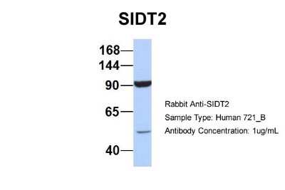 Western Blot: SIDT2 Antibody [NBP1-91551]