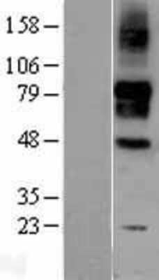 Western Blot: Siglec-9 Overexpression Lysate [NBL1-15964]