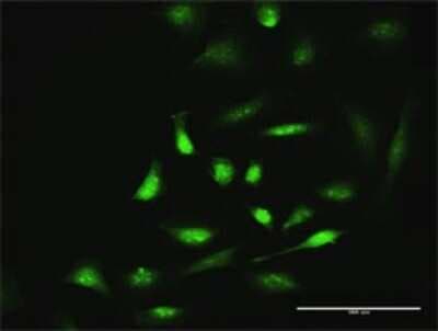 Immunocytochemistry/ Immunofluorescence: SIK1/Snf1lk Antibody [H00150094-D01P]