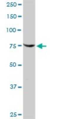 Western Blot: SIK1/Snf1lk Antibody [H00150094-D01P]
