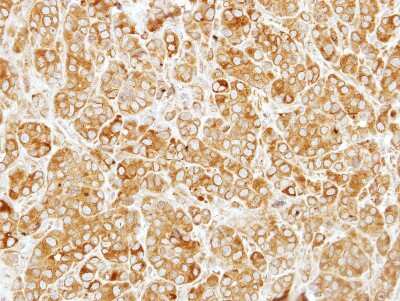 Immunohistochemistry-Paraffin: SIL1 Antibody [NBP2-20365]