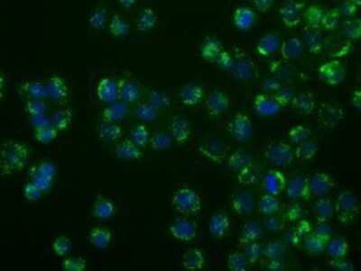 Immunocytochemistry/ Immunofluorescence: SIL1 Antibody (OTI3E3) - Azide and BSA Free [NBP2-74193]