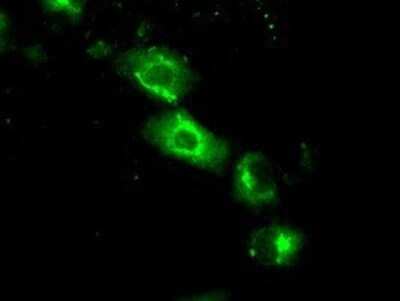 Immunocytochemistry/ Immunofluorescence: SIL1 Antibody (OTI3E3) - Azide and BSA Free [NBP2-74193]