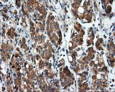Immunohistochemistry: SIL1 Antibody (OTI3E3) - Azide and BSA Free [NBP2-74193]