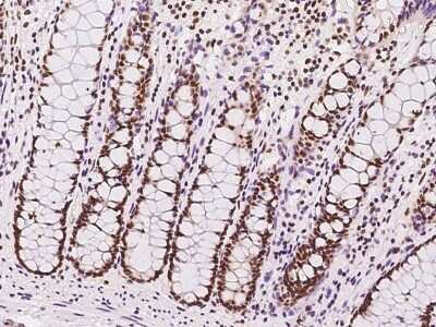 Immunohistochemistry-Paraffin: SIN3A Antibody [NBP2-98964]