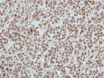 Immunohistochemistry-Paraffin: SIN3B Antibody [NBP2-20367]