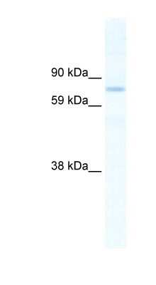 Western Blot: SIN3B Antibody [NBP1-80222]