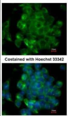 Immunocytochemistry/ Immunofluorescence: SIPA1 Antibody [NBP2-20369]