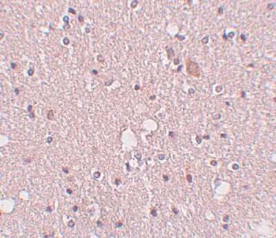 Immunohistochemistry-Paraffin: SIPA1L2 Antibody - BSA Free [NBP1-77090]