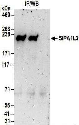 Immunoprecipitation: SIPA1L3 Antibody [NBP2-30364]