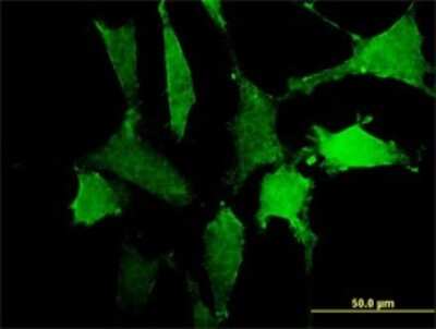 Immunocytochemistry/ Immunofluorescence: SIRP alpha/CD172a Antibody (4C7) [H00140885-M10]