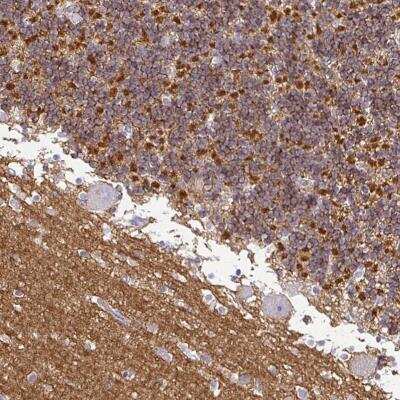 Immunohistochemistry-Paraffin: SIRP alpha/CD172a Antibody [NBP2-56723]