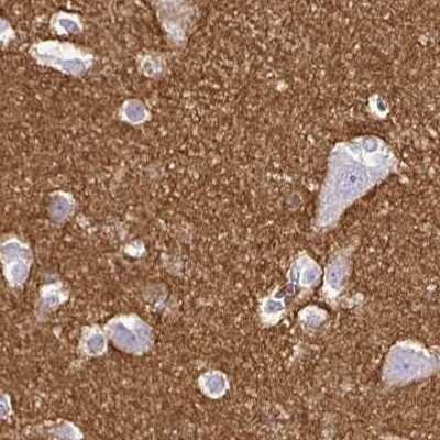 Immunohistochemistry-Paraffin: SIRP alpha/CD172a Antibody [NBP2-56723]