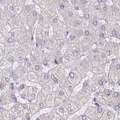 Immunohistochemistry-Paraffin: SIRP alpha/CD172a Antibody [NBP2-56723]