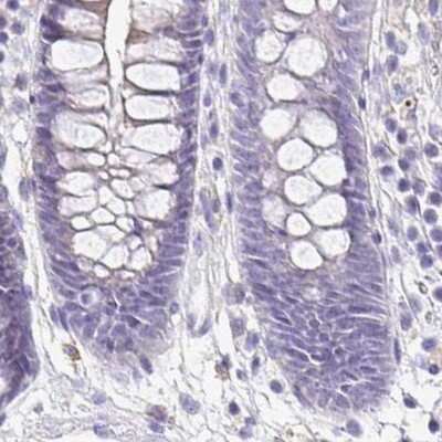 Immunohistochemistry-Paraffin: SIRP alpha/CD172a Antibody [NBP2-56723]