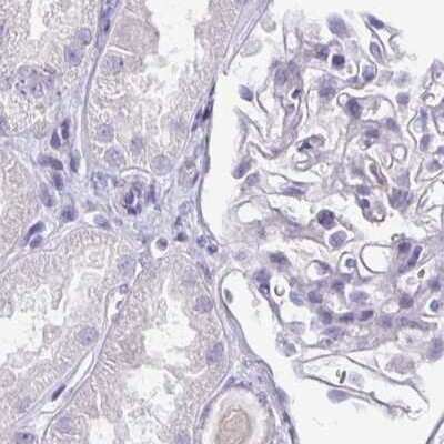 Immunohistochemistry-Paraffin: SIRP alpha/CD172a Antibody [NBP2-56723]