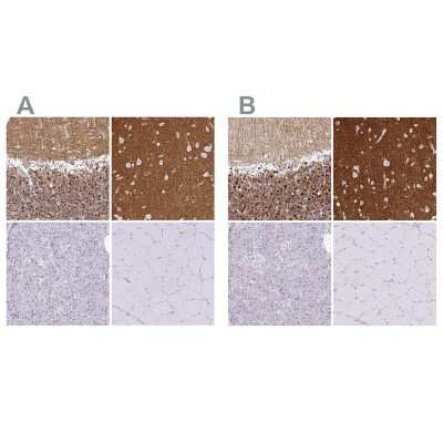 Immunohistochemistry-Paraffin: SIRP alpha/CD172a Antibody [NBP2-56723]