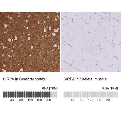Immunohistochemistry-Paraffin: SIRP alpha/CD172a Antibody [NBP2-56723]
