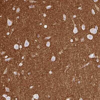 Immunohistochemistry-Paraffin: SIRP alpha/CD172a Antibody [NBP2-56723]