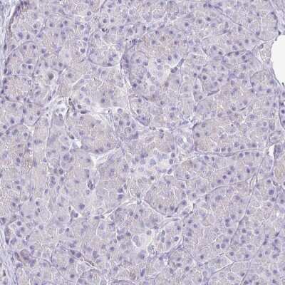 Immunohistochemistry-Paraffin: SIRP alpha/CD172a Antibody [NBP2-56723]