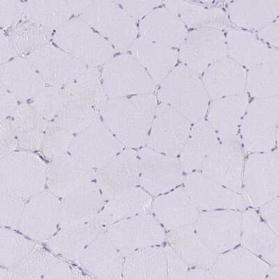 Immunohistochemistry-Paraffin: SIRP alpha/CD172a Antibody [NBP2-56723]