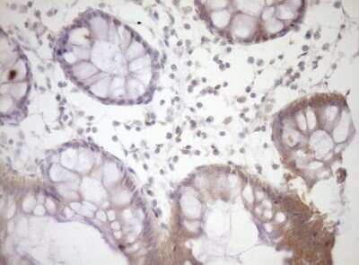 Immunohistochemistry: SIRP alpha/CD172a Antibody (OTI7B3) [NBP2-45849]