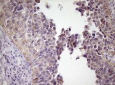 Immunohistochemistry: SIRP alpha/CD172a Antibody (OTI7B3) [NBP2-45849]