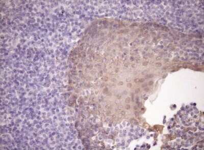 Immunohistochemistry: SIRP alpha/CD172a Antibody (OTI7B3) [NBP2-45849]