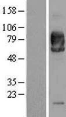 Western Blot: SIRP alpha/CD172a Overexpression Lysate [NBL1-15971]