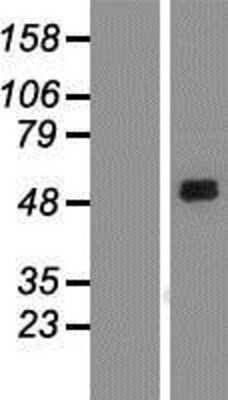 Western Blot: SIRP alpha/CD172a Overexpression Lysate [NBP2-05765]