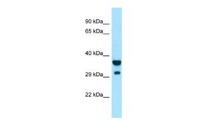 Western Blot: SIRP gamma/CD172g Antibody [NBP2-82343]