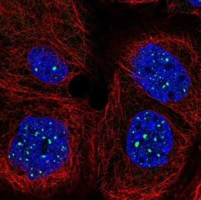 Immunocytochemistry/ Immunofluorescence: SIRPB2 Antibody [NBP2-33512]