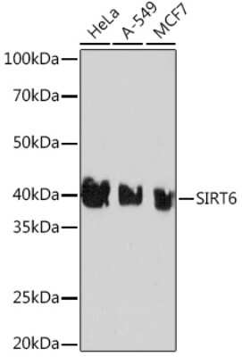 Western Blot: SIRT6 Antibody (1D0L6) [NBP3-16229]