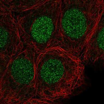 Immunocytochemistry/ Immunofluorescence: SIRT6 Antibody [NBP2-56220]