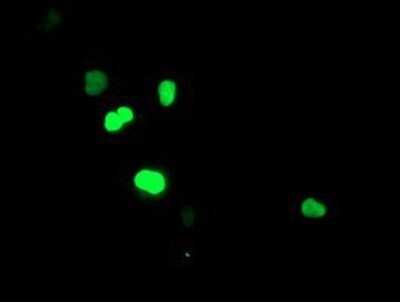 Immunocytochemistry/ Immunofluorescence: SIRT6 Antibody (OTI1G3) - Azide and BSA Free [NBP2-74198]